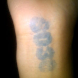 Photo of SO36